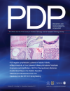 Biopsy-proven Hepatocellular Carcinoma in a 53-year-old Woman With Arginase Deficiency